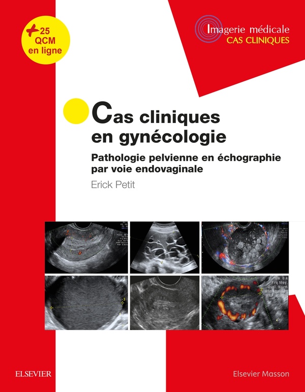 Cas cliniques en imagerie: gynécologie - Pathologie pelvienne en échographie par voie endovaginale