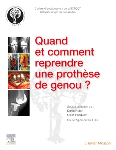 Pourquoi, quand et comment reprendre une prothèse de genou?