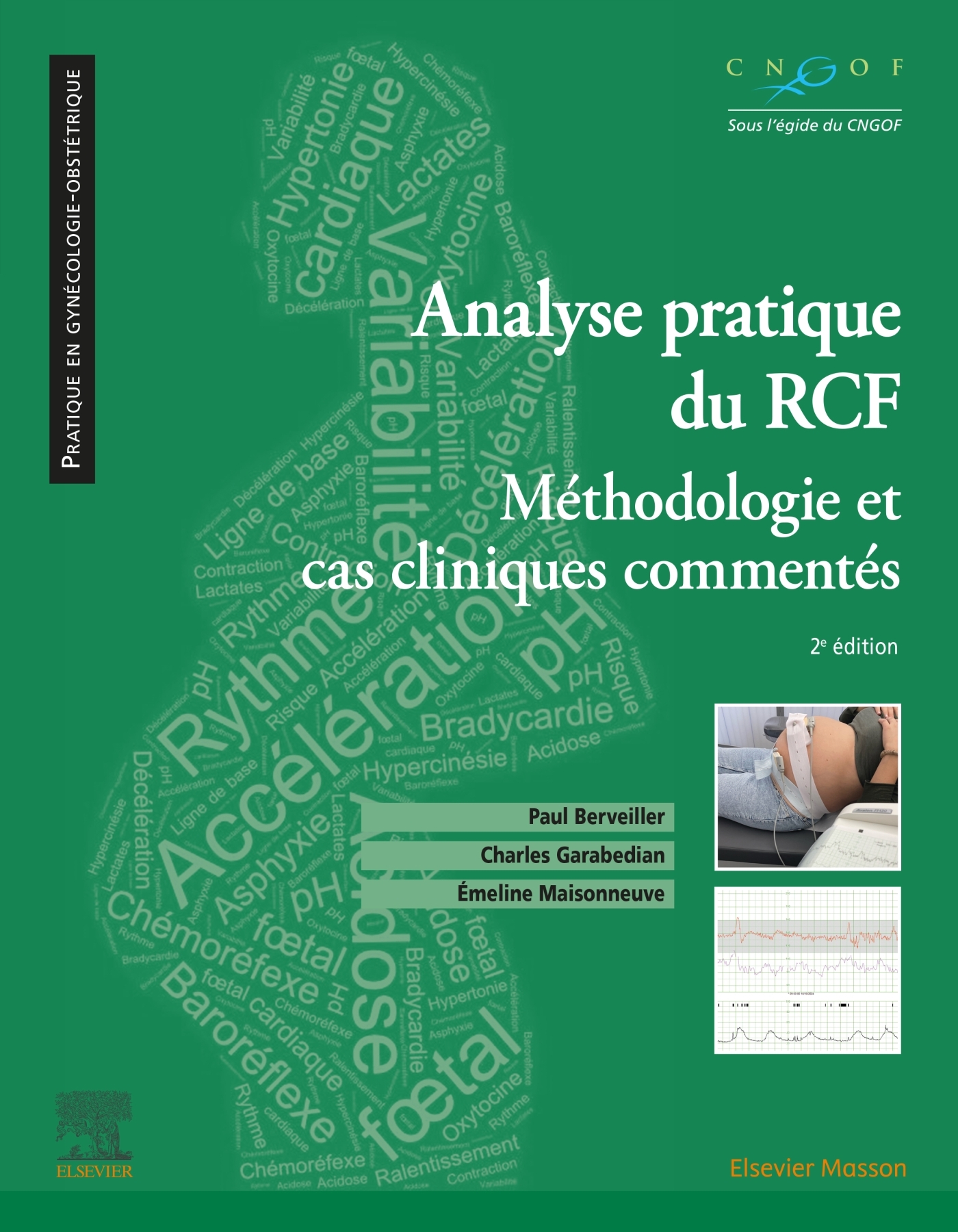 Analyse pratique du RCF: rythme cardiaque foetal - Méthodologie et cas cliniques commentés