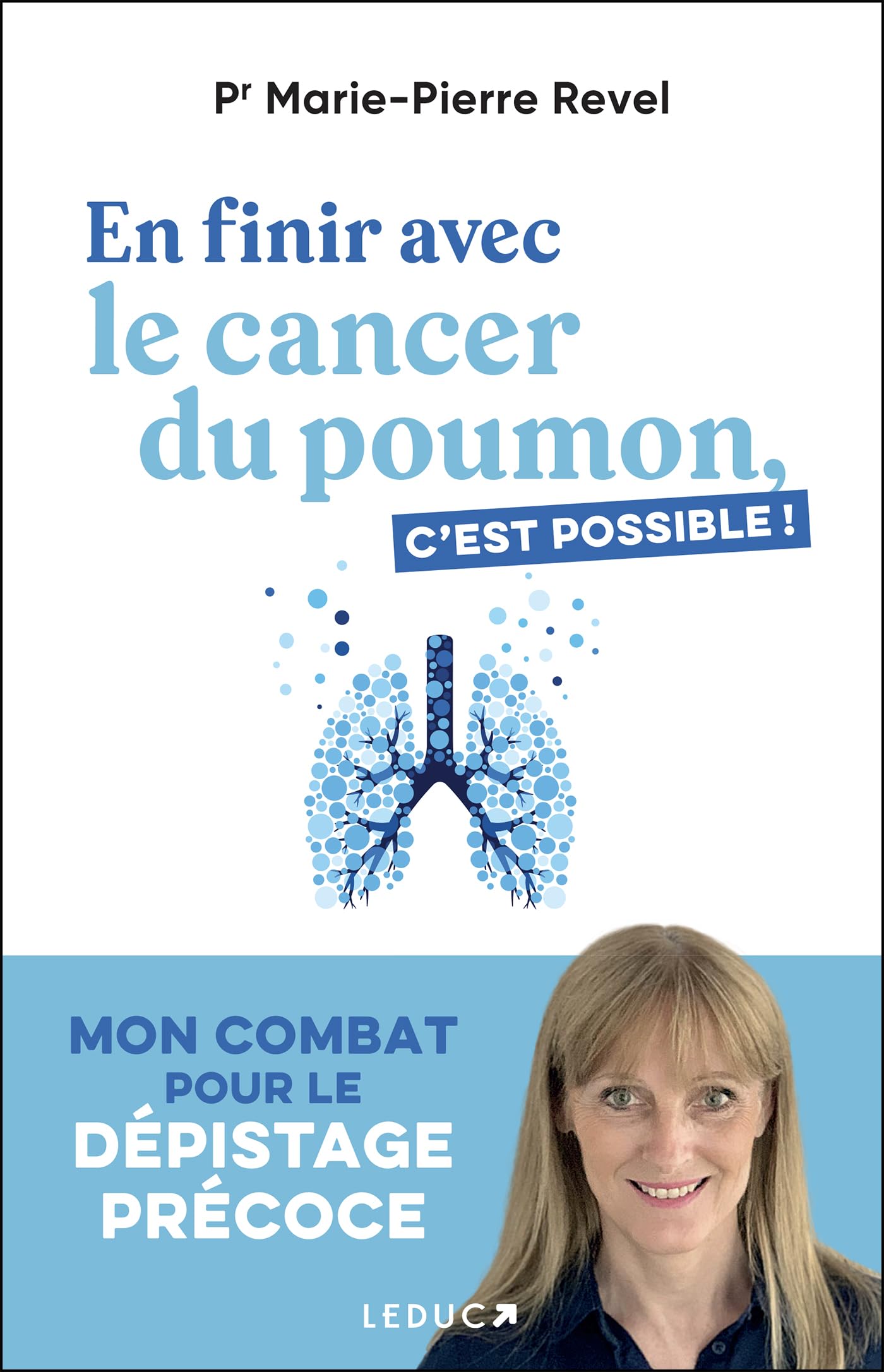 En finir avec le cancer du poumon, c'est possible! Mon combat pour le dépistage précoce