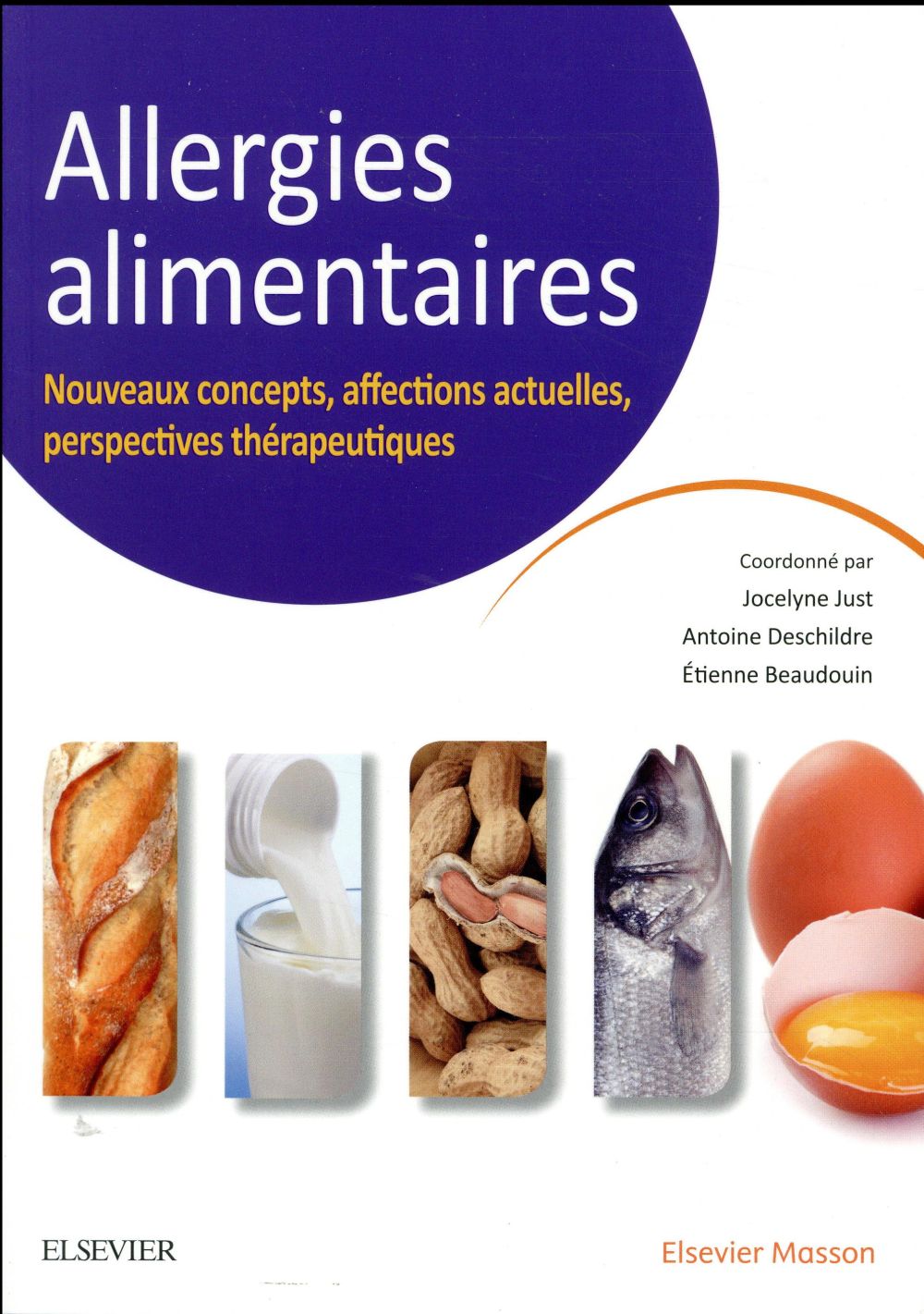 Allergies alimentaires: nouveaux concepts, affections actuelles, perspectives thérapeutiques