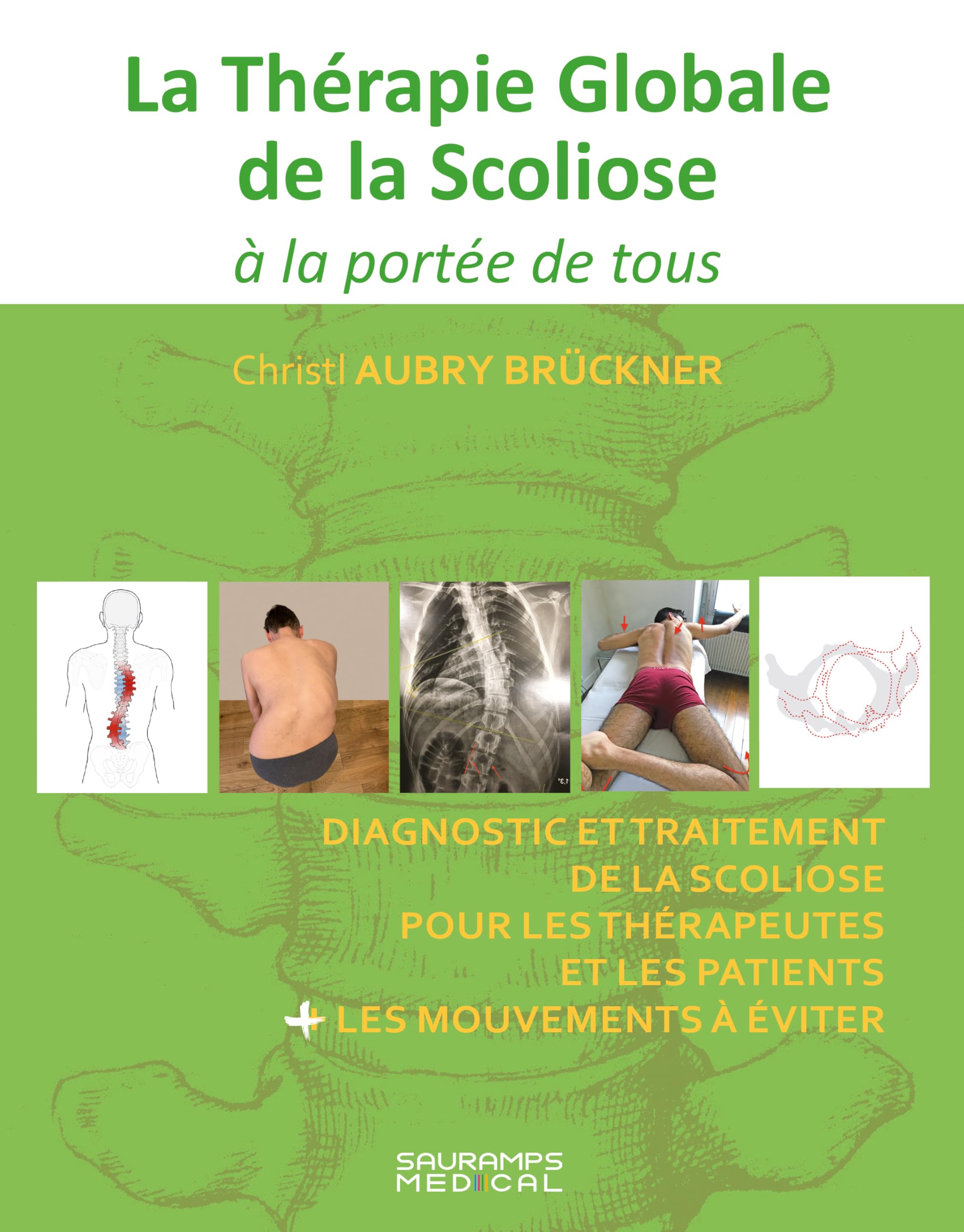 La théorie globale de la scoliose à la portée de tous: diagnostic et traitement de la scoliose pour les thérapeutes et les patients + les mouvements à éviter