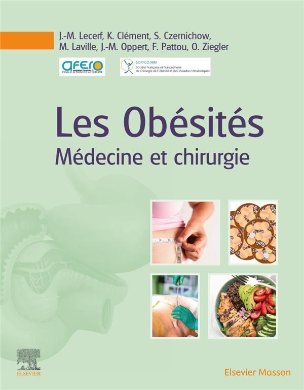 Les obésités: médecine et chirurgie
