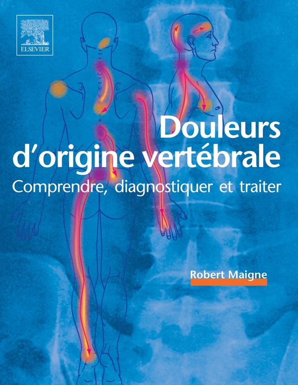 Douleurs d'origine vertébrale: comprendre, diagnostiquer et traiter