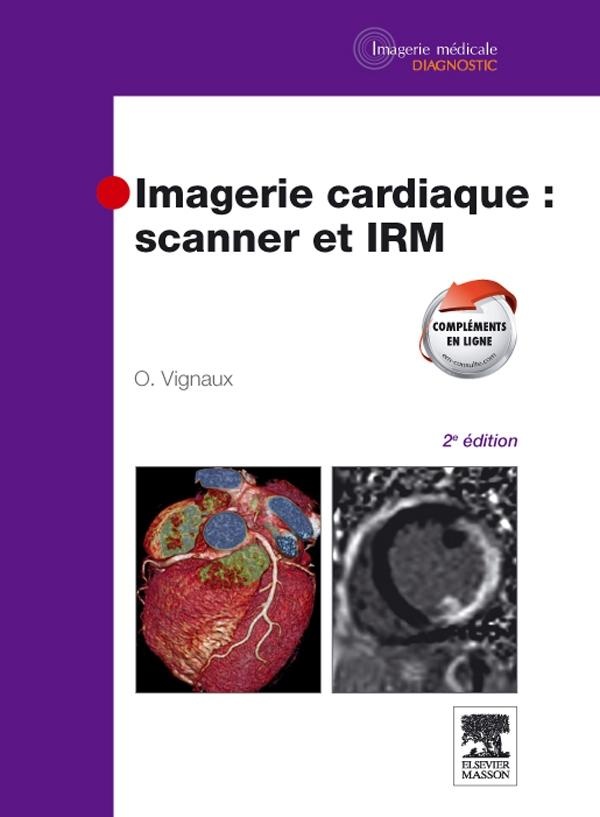 Imagerie cardiaque: scanner et IRM