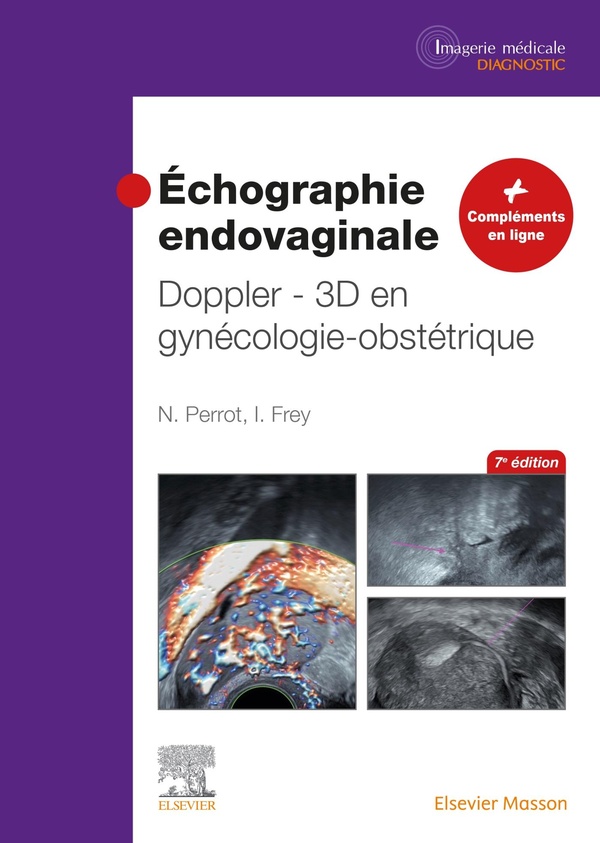 Échographie endovaginale Doppler - 3D - en gynécologie-obstétrique