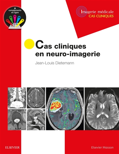 Cas cliniques en neuro-imagerie - Pathologies tumorales