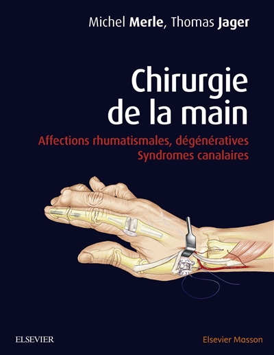 Chirurgie de la main - Affections rhumatismales, dégénératives. Syndromes canalaires