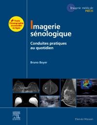 Imagerie sénologique: conduites pratiques au quotidien