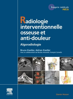 Radiologie interventionnelle osseuse et anti-douleur: algoradiologie