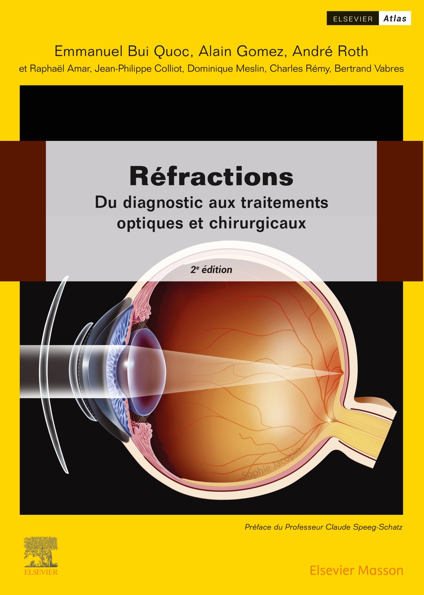 Réfractions: du diagnostic aux traitements optiques et chirurgicaux