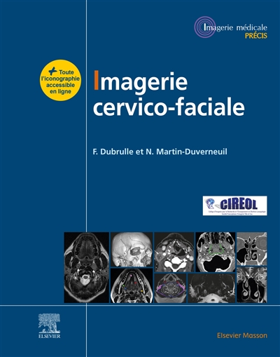 Imagerie cervicofaciale - Massif facial - Sinus - Voies aérodigestives supérieures - Pathologies cervicales - Espaces profonds