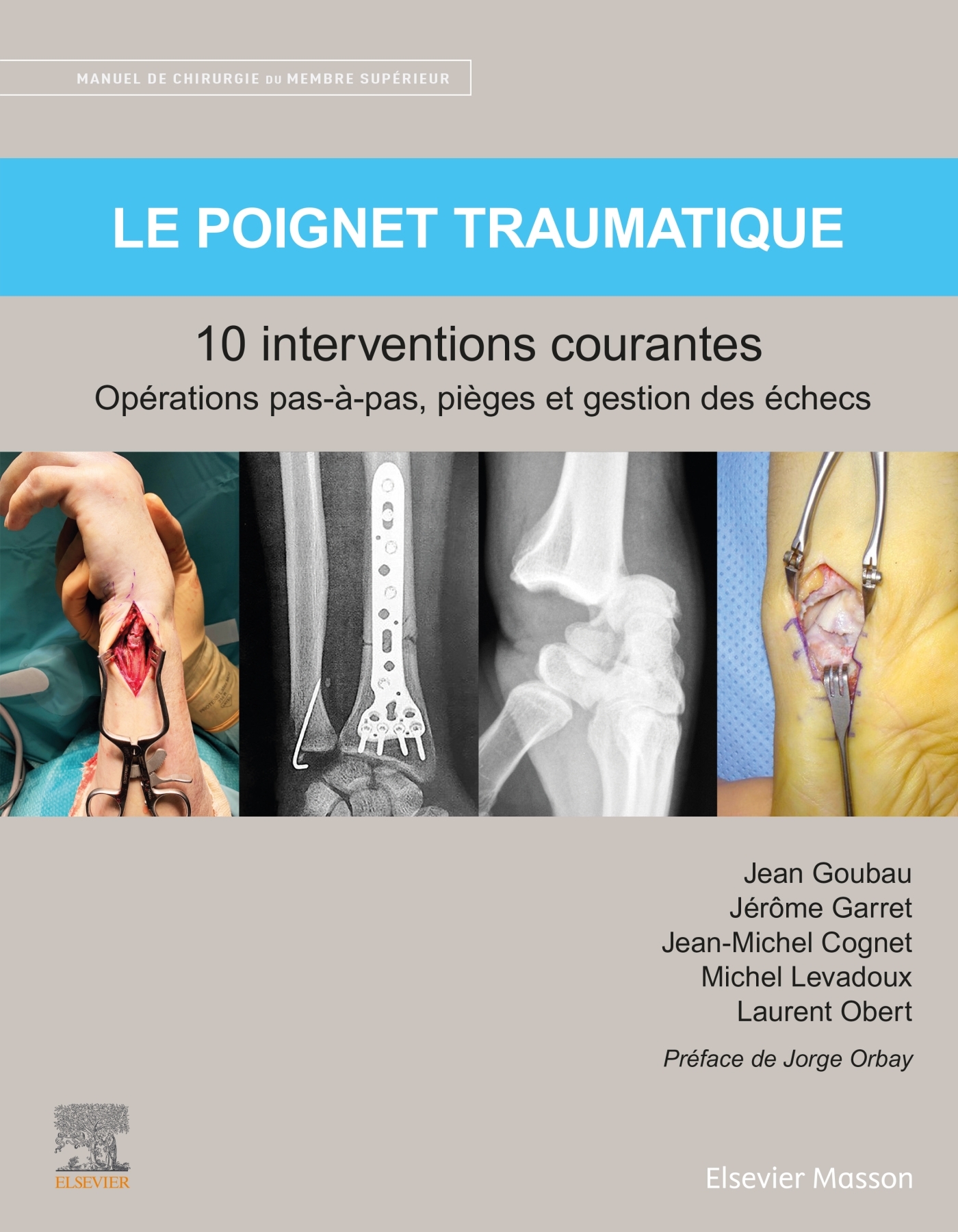 Le poignet traumatique: 10 interventions courantes: opérations pas-à-pas, pièges et gestion des échecs