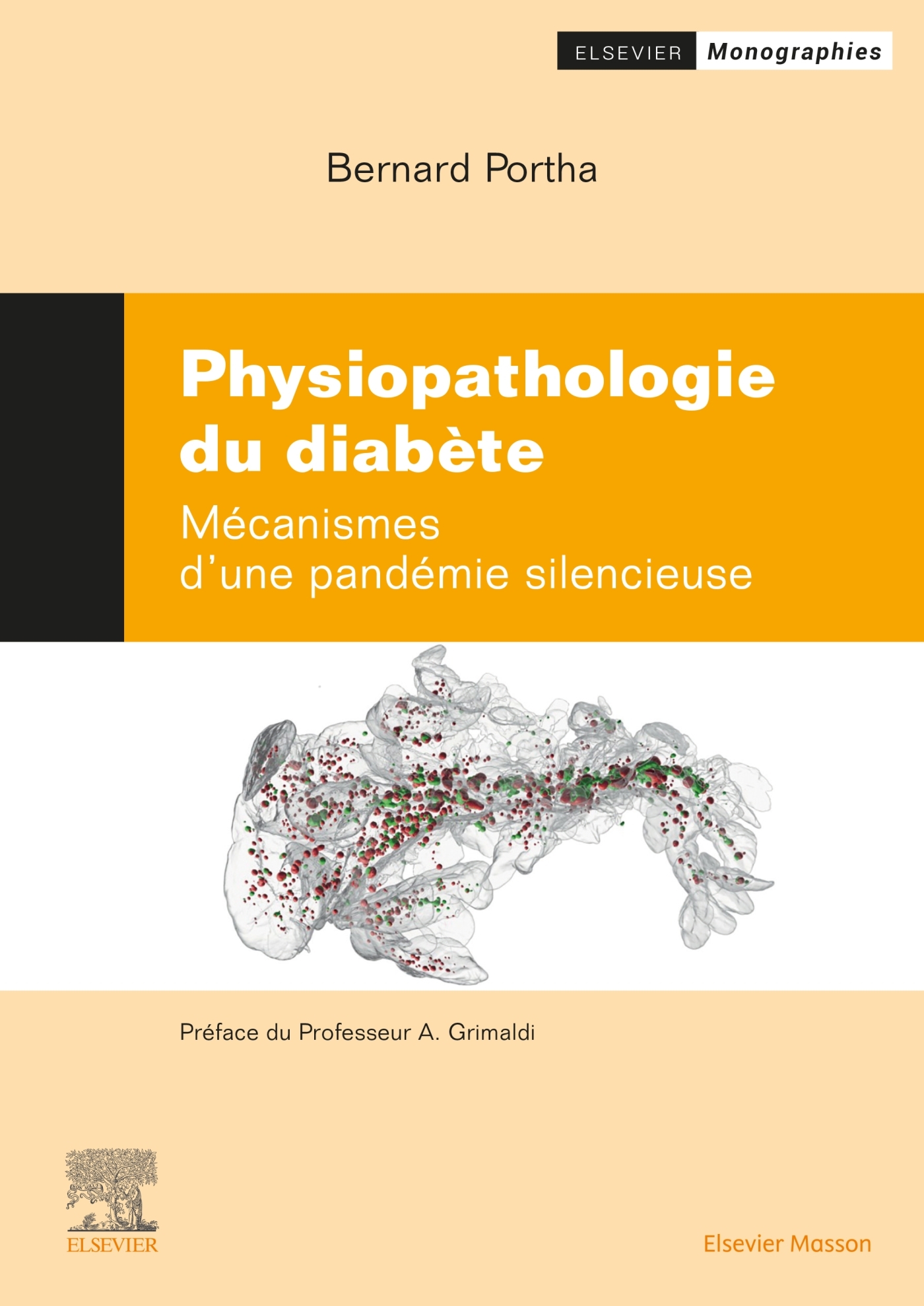 Physiopathologie des diabètes: mécanismes d'une pandémie silencieuse