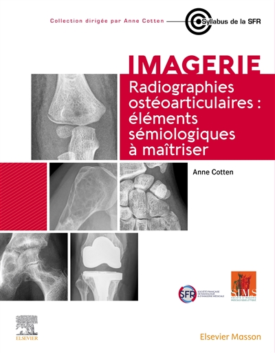 Radiographies ostéoarticulaires: éléments sémiologiques à maîtriser