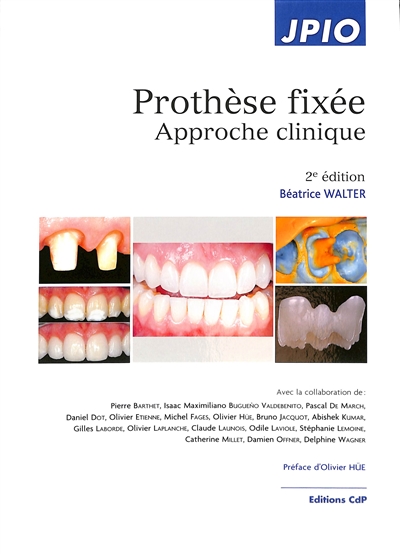 Prothèse fixée: approche clinique